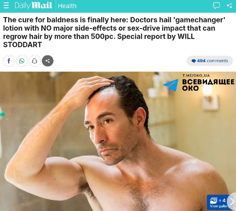 Вчені знайшли потенційний спосіб лікування облисіння 👨⚕️